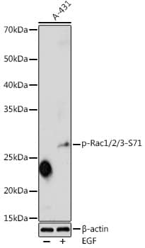 Western Blot: Rac1 [p Ser71] Antibody [NBP3-38637] - Western blot analysis of lysates from A-431 cells, using Rac1 Rabbit pAb at 1:1000 dilution. A-431 cells were treated by EGF (25 ug/mL) at 37C for 30 minutes after serum-starvation overnight.Secondary antibody: HRP-conjugated Goat anti-Rabbit IgG (H+L) at 1:10000 dilution.Lysates/proteins: 25ug per lane.Blocking buffer: 3% nonfat dry milk in TBST.Detection: ECL Enhanced Kit.Exposure time: 180s.