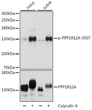 Western Blot: Myosin Phosphatase [p Ser507] Antibody [NBP3-38639] - Western blot analysis of various lysates using Myosin Phosphatase Rabbit pAb at 1:2000 dilution or PPP1R12A antibody. HeLa cells were treated by Calyculin A (100 nM) at 37C for 30 minutes after serum-starvation overnight. Jurkat cells were treated by Calyculin A (100 nM) at 37C for 30 minutes. Secondary antibody: HRP-conjugated Goat anti-Rabbit IgG (H+L) at 1:10000 dilution.Lysates/proteins: 25ug per lane.Blocking buffer: 3% BSA.Detection: ECL Basic Kit.Exposure time: 1s.