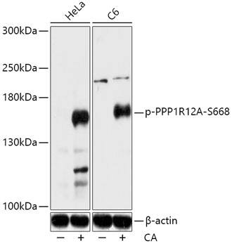 Western Blot: Myosin Phosphatase [p Ser668] Antibody [NBP3-38642] - Western blot analysis of various lysates using Myosin Phosphatase Rabbit pAb at 1:2000 dilution. Both HeLa cells and C6 cells were treated by Calyculin A (100 nM) at 37C for 30 minutes after serum-starvation overnight.Secondary antibody: HRP-conjugated Goat anti-Rabbit IgG (H+L) at 1:10000 dilution.Lysates/proteins: 25ug per lane.Blocking buffer: 3% BSA.Detection: ECL Basic Kit.Exposure time: 180s.