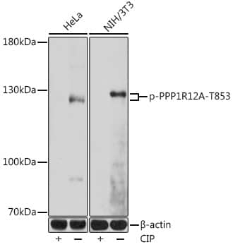 Western Blot: Myosin Phosphatase [p Thr853] Antibody [NBP3-38643] - Western blot analysis of various lysates using Myosin Phosphatase Rabbit pAb ( AP0916) at 1:1000 dilution. Hela cells were treated by CIP(20uL/400ul) at 37C for 1 hour. NIH/3T3 cells were treated by CIP(20uL/400ul) at 37C for 1 hour.Secondary antibody: HRP-conjugated Goat anti-Rabbit IgG (H+L) at 1:10000 dilution.Lysates/proteins: 25ug per lane.Blocking buffer: 3% BSA.Detection: ECL Basic Kit.Exposure time: 90s.