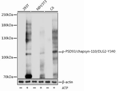 Western Blot: PSD93 [p Tyr340] Antibody [NBP3-38644] - Western blot analysis of various lysates using PSD93 Rabbit pAb at 1:1000 dilution. 293T cells were treated by ATP(5 mM) at 30C for 1 hour. NIH/3T3 cells were treated by ATP(5 mM) at 30C for 1 hour. C6 cells were treated by ATP(5 mM) at 30C for 1 hour.Secondary antibody: HRP-conjugated Goat anti-Rabbit IgG (H+L) at 1:10000 dilution.Lysates/proteins: 25ug per lane.Blocking buffer: 3% BSA.Detection: ECL Basic Kit.Exposure time: 1s.