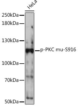 Western Blot: PKC mu [p Ser916] Antibody [NBP3-38645] - Western blot analysis of lysates from HeLa cells, using PKC mu Rabbit pAb at 1:1000 dilution.Secondary antibody: HRP-conjugated Goat anti-Rabbit IgG (H+L) at 1:10000 dilution.Lysates/proteins: 25ug per lane.Blocking buffer: 3% nonfat dry milk in TBST.Detection: ECL Basic Kit.Exposure time: 90s.