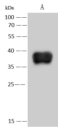 Western Blot: Monkeypox Virus Envelope H3 Antibody [NBP3-40577] - NBP3-40577 at 1:5000 dilution. Lane A: Monkeypox Virus (MPXV) Envelope protein H3 5ng Secondary Goat Anti-Rabbit IgG (H+L) [HRP] at 1/10000 dilution Developed using the ECL technique. Performed under reducing conditions. 