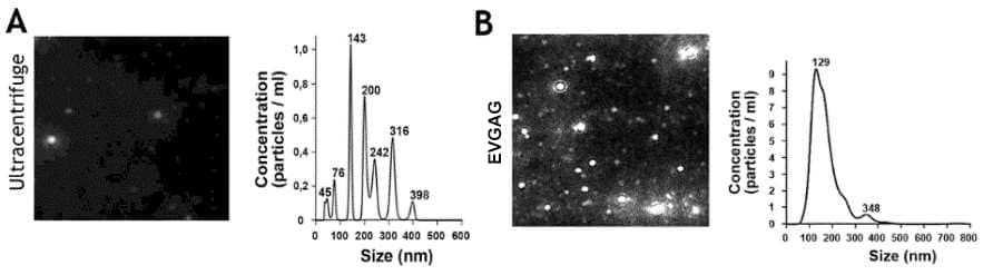 evGAG - Extracellular Vesicles Purification Kit [NBP3-41044] - Nanoparticle tracking analysis (NTA) image of urine isolated EVs showing particle size (nm) and concentration (particles/ml) comparing EVs isolated by (A) ultracentrifugation or by (B) evGAG. 
