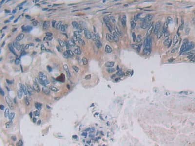 Immunohistochemistry-Paraffin IFN-alpha G/IFNA5 Antibody (C2)