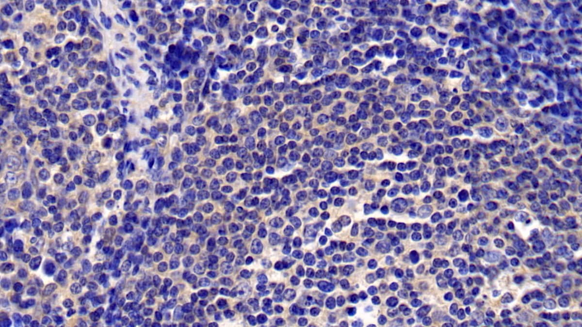 Immunohistochemistry-Paraffin: CXCL16 Antibody (C1) [NBP3-41062] - DAB staining on IHC-P; Sample: Human Stomach Tissue; Primary Ab: 30ug/ml NBP3-41062; Second Ab: 2ug/mL HRP-Linked Caprine Anti-Mouse IgG Polyclonal Antibody