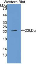 Western Blot: IL-37/IL-1F7 Antibody (1#) [NBP3-41064] - Western Blot; Sample: Recombinant IL-37/IL-1F7, Human.