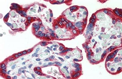 Immunohistochemistry-Paraffin: PDGF-AA Antibody (C1) [NBP3-41066] - Vector Red staining on IHC-P; Samples: Human Placenta Tissue; Primary Ab: 20ug/ml NBP3-41066; Second Ab: 2ug/mL HRP-Linked Caprine Anti-Mouse IgG Monoclonal Antibody