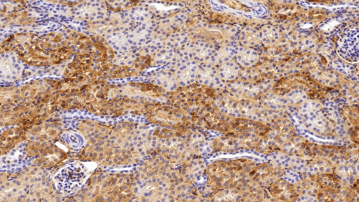 Immunohistochemistry-Paraffin: FGF acidic/FGF1 Antibody (C14) [NBP3-41068] - DAB staining on IHC-P; Sample: Human Kidney Tissue; Primary Ab: 20ug/ml NBP3-41068; Second Ab: 2ug/mL HRP-Linked Caprine Anti-Mouse IgG Polyclonal Antibody