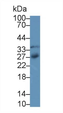 Western Blot: IGFBP-4 Antibody (A3) [NBP3-41069] - Sample: Rat Uterus lysate; Primary Ab: 2ug/ml NBP3-41069; Second Ab: 0.2ug/mL HRP-Linked Caprine Anti-Mouse IgG Polyclonal Antibody