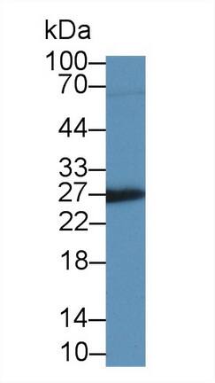 Western Blot: IGFBP-4 Antibody (A3) [NBP3-41069] - Sample: Rat Placenta lysate; Primary Ab: 2ug/ml NBP3-41069; Second Ab: 0.2ug/mL HRP-Linked Caprine Anti-Mouse IgG Polyclonal Antibody