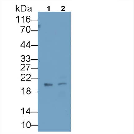 Western Blot: IGFBP-4 Antibody (C15) [NBP3-41070] - Sample: Lane1: Sp2/0 cell lysate; Lane2: Rat Placenta lysate Primary Ab: 3ug/ml NBP3-41070; Second Ab: 0.2ug/mL HRP-Linked Caprine Anti-Mouse IgG Polyclonal Antibody