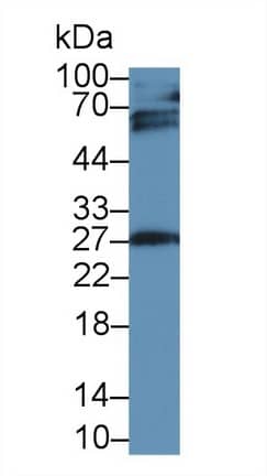 Western Blot: IGFBP-4 Antibody (A4) [NBP3-41071] - Sample: Rat Placenta lysate; Primary Ab: 2ug/ml NBP3-41071; Second Ab: 0.2ug/mL HRP-Linked Caprine Anti-Mouse IgG Polyclonal Antibody