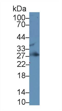 Western Blot: IGFBP-4 Antibody (A4) [NBP3-41071] - Sample: Rat Uterus lysate; Primary Ab: 2ug/ml NBP3-41071; Second Ab: 0.2ug/mL HRP-Linked Caprine Anti-Mouse IgG Polyclonal Antibody