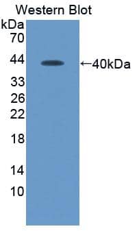 Western Blot: CXCL12/SDF-1 Antibody (C3) [NBP3-41072] - Sample: Recombinant CXCL12/SDF-1, Human.