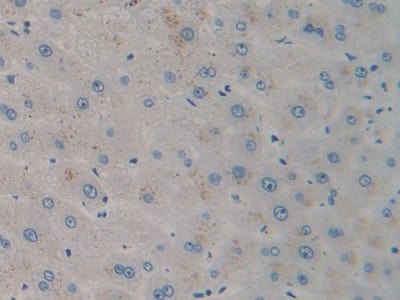 Immunohistochemistry-Paraffin: CXCL12/SDF-1 Antibody (C3) [NBP3-41072] - DAB staining on IHC-P; Samples: Human Liver Tissue