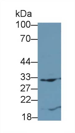 Western Blot: Flt-3 Ligand/FLT3L Antibody (D13) [NBP3-41075] - Sample: Jurkat cell lysate Primary Ab: 3ug/ml NBP3-41075; Second Ab: 0.2ug/mL HRP-Linked Caprine Anti-Mouse IgG Polyclonal Antibody