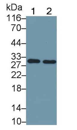 Western Blot: Flt-3 Ligand/FLT3L Antibody (D13) [NBP3-41075] - Sample: Lane1: Hela cell lysate; Lane2: MCF7 cell lysate Primary Ab: 2ug/ml NBP3-41075; Second Ab: 0.2ug/mL HRP-Linked Caprine Anti-Mouse IgG Polyclonal Antibody