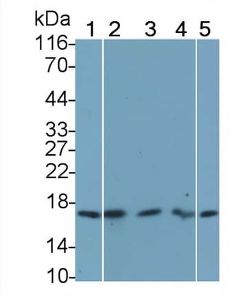 Western Blot: FGF acidic/FGF1 Antibody (C16) [NBP3-41078] - Sample: Lane1: Rat Cerebrum lysate; Lane2: Rat Heart lysate; Lane3: Mouse Heart lysate; Lane4: Mouse Kidney lysate; Lane5: Porcine Heart lysate Primary Ab: 0.8ug/ml NBP3-41078; Second Ab: 0.2ug/mL HRP-Linked Caprine Anti-Mouse IgG Polyclonal Antibody
