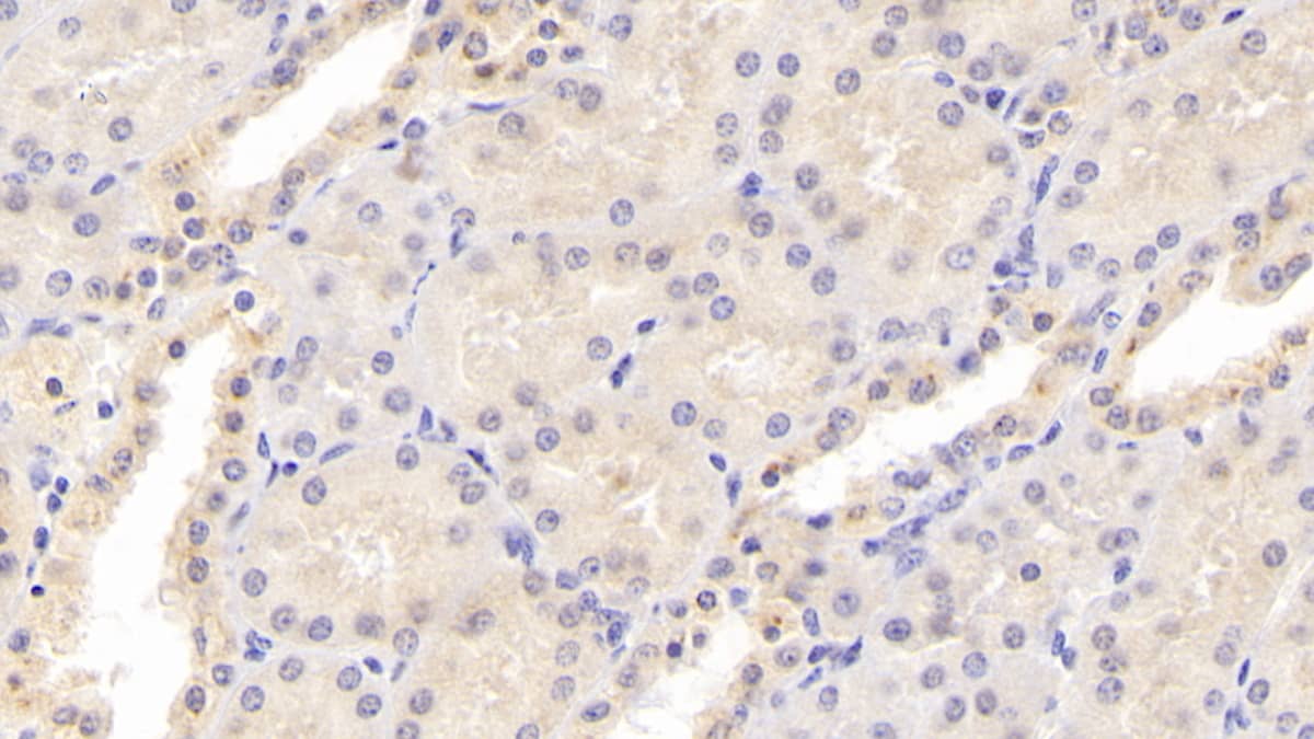 Immunohistochemistry-Paraffin: Osteoprotegerin/TNFRSF11B Antibody (C2) [NBP3-41079] - DAB staining on IHC-P; Sample: Human Liver Tissue; Primary Ab: 20ug/ml NBP3-41079; Second Ab: 2ug/mL HRP-Linked Caprine Anti-Mouse IgG Polyclonal Antibody