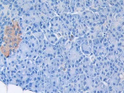 Immunohistochemistry-Paraffin: CXCL12/SDF-1 Antibody (C2) [NBP3-41080] - DAB staining on IHC-P; Sample: Human Pancreas Tissue; Primary Ab: 30ug/ml NBP3-41080; Second Ab: 2ug/mL HRP-Linked Caprine Anti-Mouse IgG Polyclonal Antibody