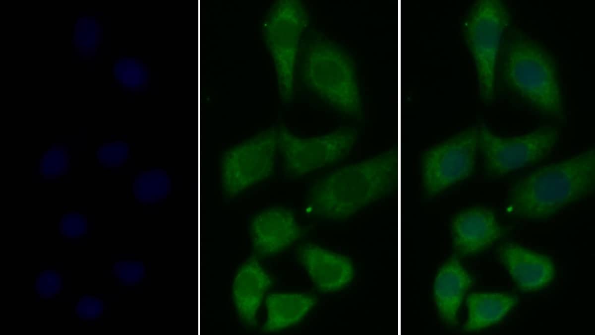 Immunocytochemistry/ Immunofluorescence: t-Plasminogen Activator/tPA Antibody (K17) [NBP3-41082] - Human Hela cell; Primary Ab: 20ug/ml NBP3-41082; Second Ab: 5ug/ml FITC-conjugated Goat Anti-Mouse IgG Polyclonal Antibody