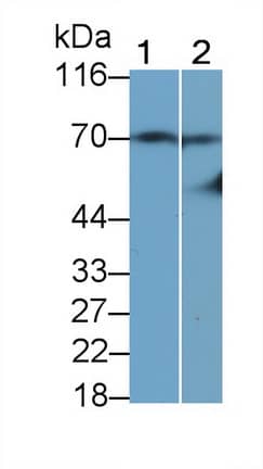 Western Blot: t-Plasminogen Activator/tPA Antibody (K17) [NBP3-41082] -  Sample: Lane 1: Human Serum; Lane 2: Human Plasma Primary Ab: 1ug/ml NBP3-41082; Second Ab: 0.2ug/mL HRP-conjugated Goat Anti-Mouse IgG Polyclonal Antibody