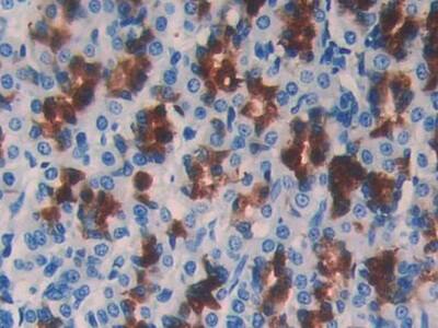 Immunohistochemistry-Paraffin: Cystatin B/Stefin B Antibody (C13) [NBP3-41083] - DAB staining on IHC-P; Samples: Rat Stomach Tissue; Primary Ab: 40ug/ml NBP3-41083