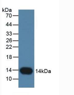 Western Blot: Cystatin B/Stefin B Antibody (C6) [NBP3-41084] - Sample: Rat Placenta Tissue.