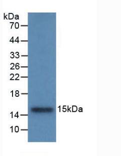 Western Blot: Cystatin B/Stefin B Antibody (C6) [NBP3-41084] - Sample: Recombinant Cystatin B/Stefin B, Rat.