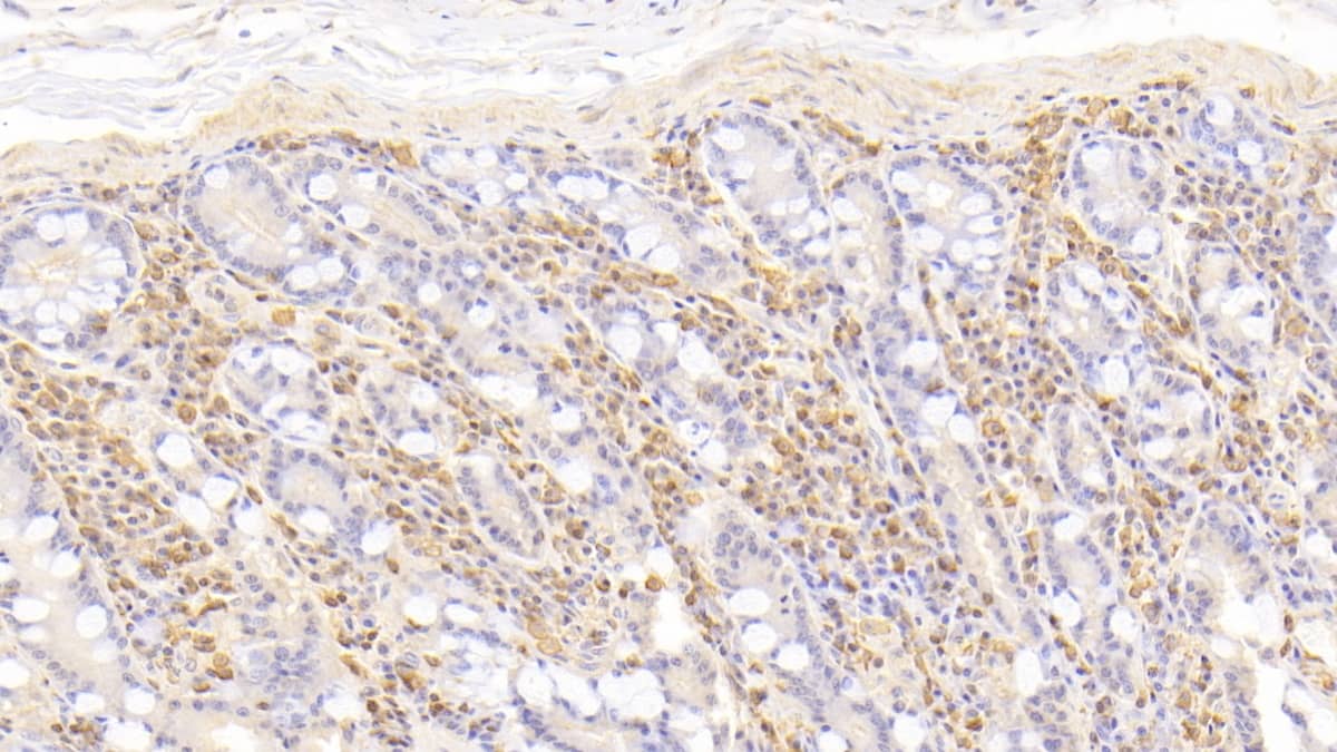 Immunohistochemistry-Paraffin: CD177 Antibody (C11) [NBP3-41085] - DAB staining on IHC-P; Sample: Human Small intestine Tissue; Primary Ab: 30ug/ml NBP3-41085; Second Ab: 2ug/mL HRP-Linked Caprine Anti-Mouse IgG Polyclonal Antibody