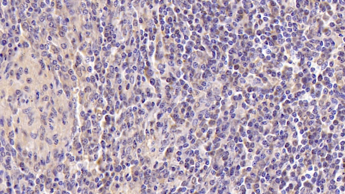 Immunohistochemistry-Paraffin: CD177 Antibody (C3) [NBP3-41086] - DAB staining on IHC-P; Sample: Human Spleen Tissue; Primary Ab: 20ug/ml NBP3-41086; Second Ab: 2ug/mL HRP-Linked Caprine Anti-Mouse IgG Polyclonal Antibody