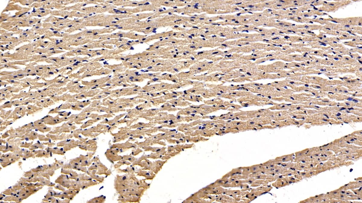 Immunohistochemistry-Paraffin: Osteoprotegerin/TNFRSF11B Antibody (D2) [NBP3-41087] - DAB staining on IHC-P; Sample: Rat Cardiac Muscle Tissue; Primary Ab: 30ug/ml NBP3-41087; Second Ab: 2ug/mL HRP-Linked Caprine Anti-Mouse IgG Polyclonal Antibody