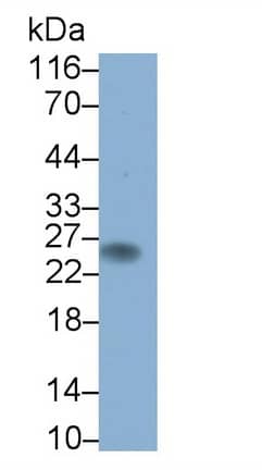 Western Blot: CD3 gamma Antibody (D14) [NBP3-41088] - Sample: Human Serum Primary Ab: 1ug/ml NBP3-41088; Second Ab: 0.2ug/mL HRP-Linked Caprine Anti-Mouse IgG Polyclonal Antibody