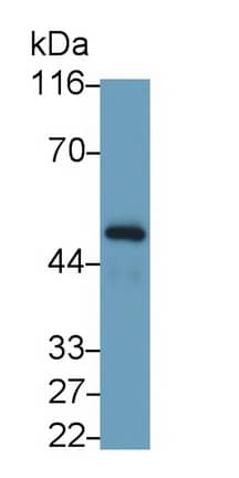 Western Blot: IFN-gamma R1/CD119 Antibody (C3) [NBP3-41089] - Sample: 293T cell lysate Primary Ab: 0.2ug/ml NBP3-41089; Second Ab: 0.2ug/mL HRP-Linked Caprine Anti-Mouse IgG Polyclonal Antibody