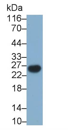 Western Blot: CD3 gamma Antibody (D13) [NBP3-41090] - Sample: Human Serum Primary Ab: 1ug/ml NBP3-41090; Second Ab: 0.2ug/mL HRP-Linked Caprine Anti-Mouse IgG Polyclonal Antibody