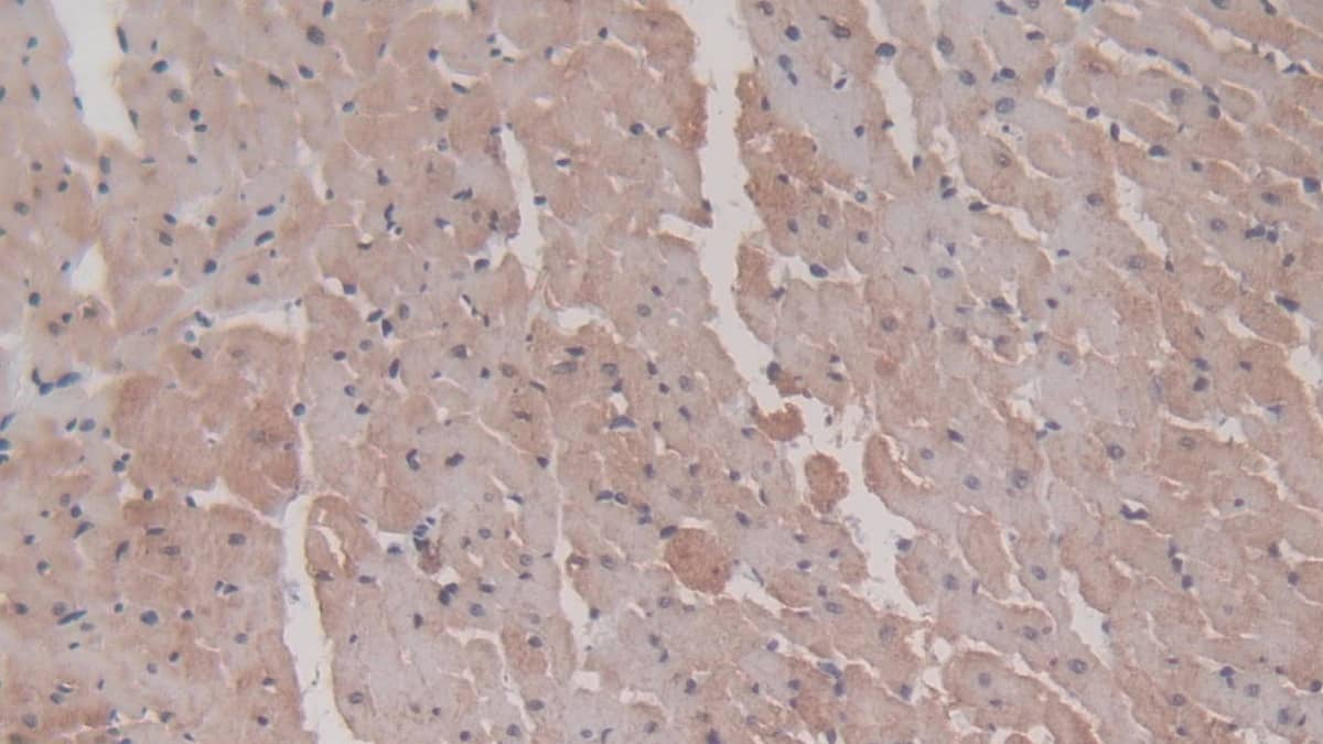 Immunohistochemistry-Paraffin: HSP20/HSPB6 Antibody (C9) [NBP3-41093] - DAB staining on IHC-P;  Sample: Rat Cardiac Muscle Tissue; Primary Ab: 20ug/ml NBP3-41093; Second Ab: 2ug/mL HRP-Linked Caprine Anti-Mouse IgG Polyclonal Antibody;