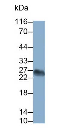 Western Blot: CD3 gamma Antibody (D12) [NBP3-41094] - Sample: Human Serum Primary Ab: 1ug/ml NBP3-41094; Second Ab: 0.2ug/mL HRP-Linked Caprine Anti-Mouse IgG Polyclonal Antibody