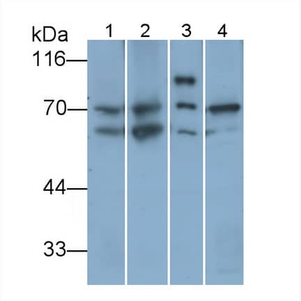 Western Blot: T Plastin Antibody (C14) [NBP3-41099] - Sample: Lane1: Rat Heart lysate; Lane2: Rat Liver lysate; Lane3: Rat Cerebrum lysate; Lane4: MCF7 cell lysate Primary Ab: 0.1ug/ml NBP3-41099; Second Ab: 0.2ug/mL HRP-Linked Caprine Anti-Mouse IgG Polyclonal Antibody