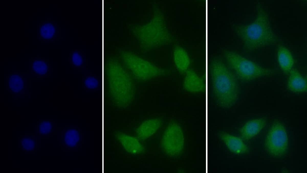 Immunocytochemistry /Immunofluorescence: T Plastin Antibody (C5) [NBP3-41100] - FITC staining on IF; Sample: Human Hela cell; Primary Ab: 30ug/ml NBP3-41100; Second Ab: 2ug/ml FITC-Linked Caprine Anti-Mouse IgG Polyclonal Antibody