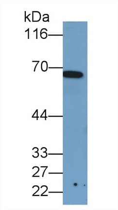 Western Blot: T Plastin Antibody (C5) [NBP3-41100] - Sample: Porcine Heart lysate Primary Ab: 1ug/ml NBP3-41100; Second Ab: 0.2ug/mL HRP-Linked Caprine Anti-Mouse IgG Polyclonal Antibody