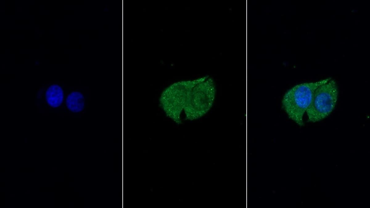 Immunocytochemistry /Immunofluorescence: T Plastin Antibody (C10) [NBP3-41102] - FITC staining on IF; Sample: Human Hela cell; Primary Ab: 30ug/ml NBP3-41102; Second Ab: 2ug/ml FITC-Linked Caprine Anti-Mouse IgG Polyclonal Antibody