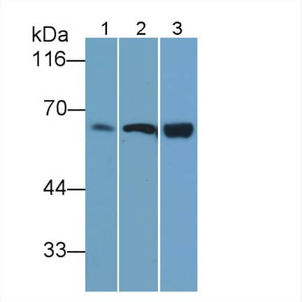 Western Blot: T Plastin Antibody (C10) [NBP3-41102] - Sample: Lane1: Porcine Heart lysate; Lane2: MCF7 cell lysate; Lane3: Hela cell lysate Primary Ab: 0.2ug/ml NBP3-41102; Second Ab: 0.2ug/mL HRP-Linked Caprine Anti-Mouse IgG Polyclonal Antibody