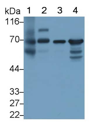 Western Blot: T Plastin Antibody (C2) [NBP3-41103] - Sample: Lane1: Porcine Liver lysate; Lane2: Rat Cerebrum lysate; Lane3: MCF7 cell lysate; Lane4: Hela cell lysate Primary Ab: 0.2ug/ml NBP3-41103; Second Ab: 0.2ug/mL HRP-Linked Caprine Anti-Mouse IgG Polyclonal Antibody