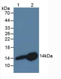 Western Blot: Cystatin B/Stefin B Antibody (C7) [NBP3-41104] - Sample: Lane1: Rat Lymph Node Tissue; Lane2: Rat Placenta Tissue.