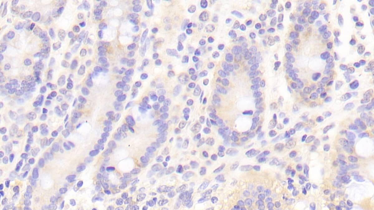 Immunohistochemistry-Paraffin: Fc gamma RIIIB/CD16b Antibody [NBP3-41105] - DAB staining on IHC-P; Samples: Human Small intestine Tissue; Primary Ab: 20ug/ml NBP3-41105; Second Ab: 2ug/mL HRP-Linked Caprine Anti-Rabbit IgG Polyclonal Antibody