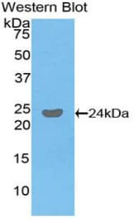 Western Blot: Fc gamma RIIIB/CD16b Antibody [NBP3-41105] - Sample: Recombinant protein.