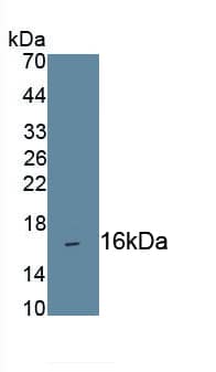 Western Blot: CD160 Antibody (C1) [NBP3-41115] - Recombinant Human CD160