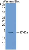 Western Blot: RBP2 Antibody (D2) [NBP3-41116] - Sample: Recombinant RBP2, Human.