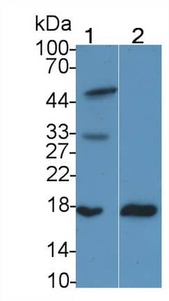 Western Blot: RBP2 Antibody (D2) [NBP3-41116] - Sample: Lane1: Mouse Small intestine lysate; Lane2: Rat Small intestine lysate Primary Ab: 2ug/ml NBP3-41116; Second Ab: 0.2ug/mL HRP-Linked Caprine Anti-Mouse IgG Polyclonal Antibody